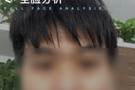 抖音弄大脸在哪里？揭秘抖音大脸效果背后的秘密